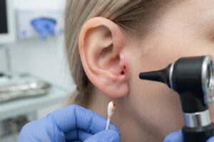Infection de l'oreille